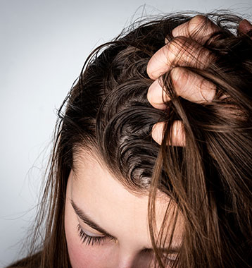 Capelli grassi