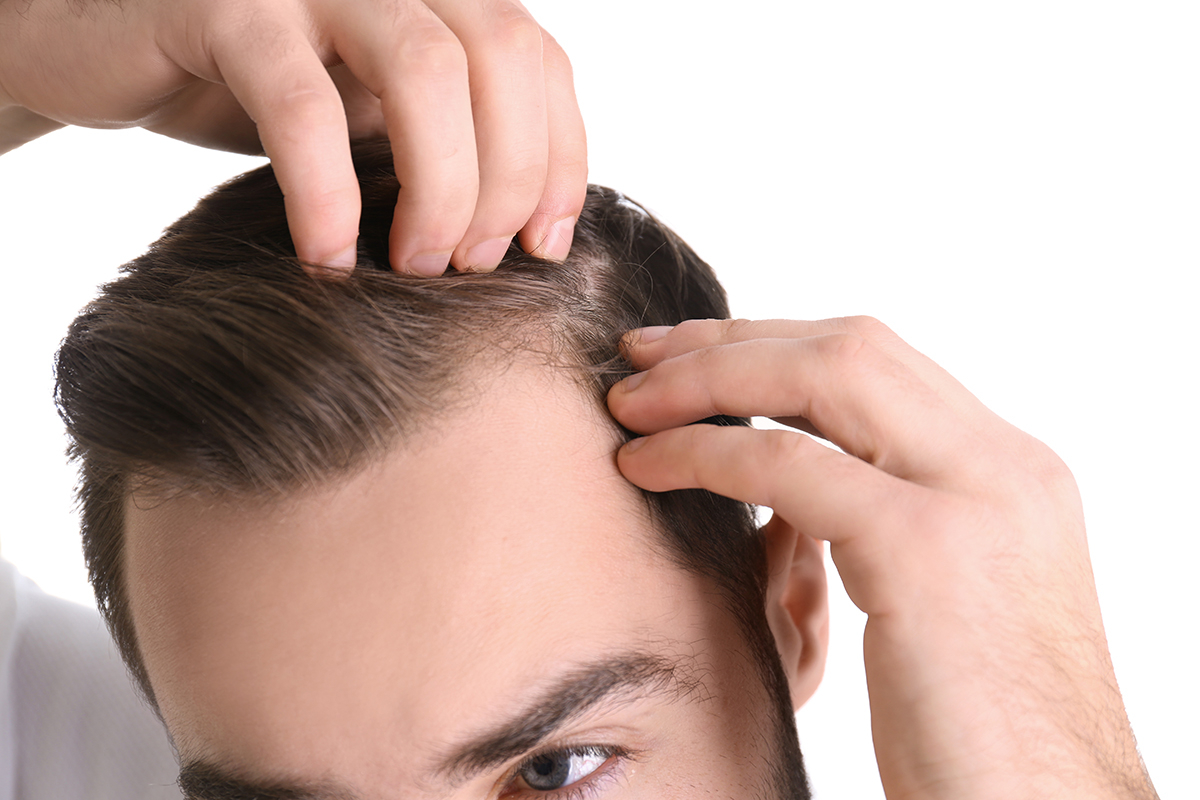 Capelli miniaturizzati