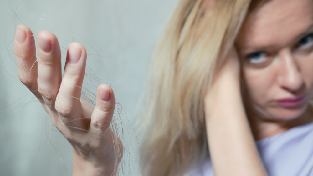 Alopecia da radiazioni