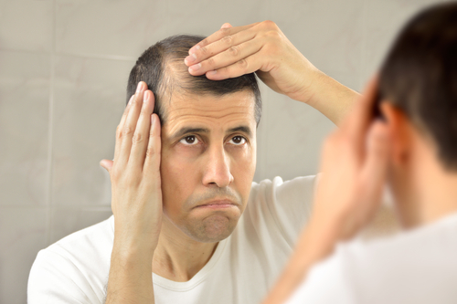 Caduta capelli: manifestazione, cause e prevenzione