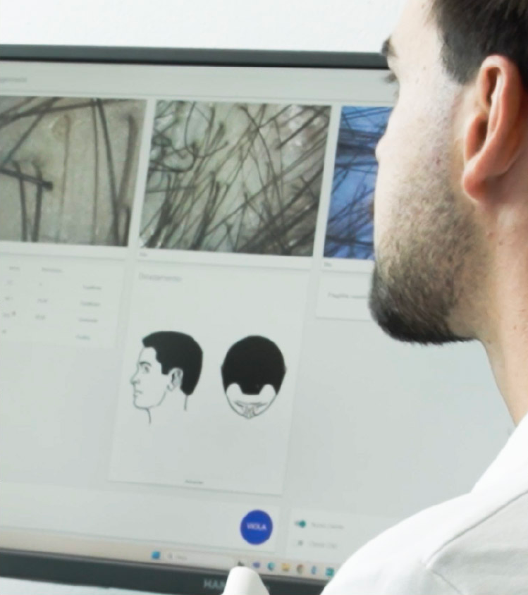 Scelta della soluzione migliore