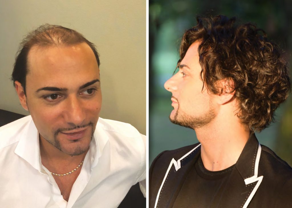 CHI CI HA SCELTO - Sistema CRL