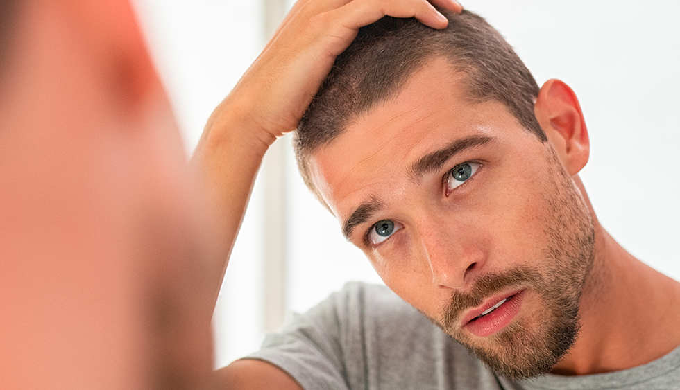 Trapianto dei Capelli: Tecniche, Risultati e Candidati