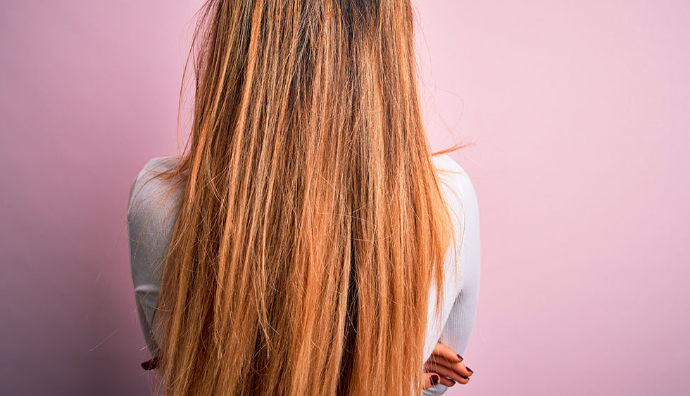 Febbre, stress e caduta capelli