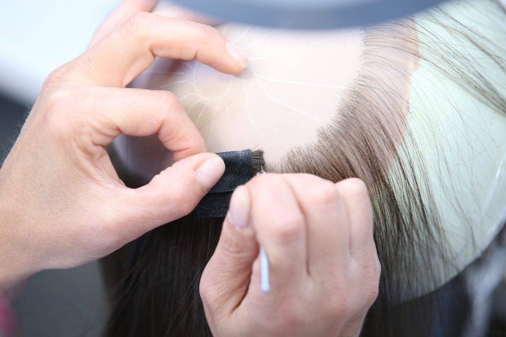 Il Sistema d’infoltimento CRLAB: una soluzione non invasiva per dare una risposta concreta all’alopecia androgenetica