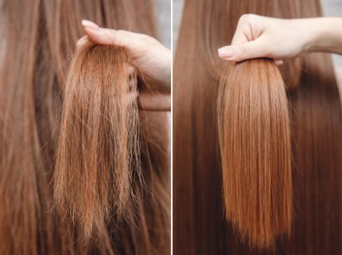 Che cos’è la ricostruzione dei capelli