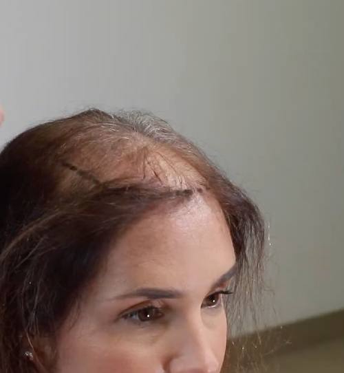 Giovanna - Prima
