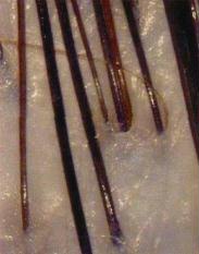 Immagini micro del cuoio capelluto